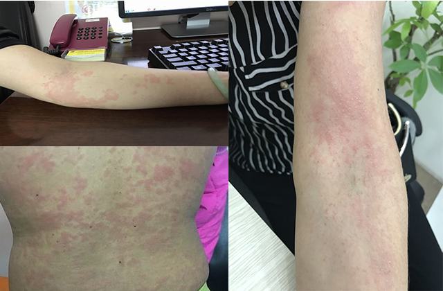 Xét nghiệm sán chó ở đâu tphcm